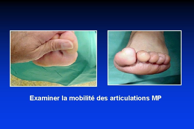 Examiner la mobilité des articulations MP 