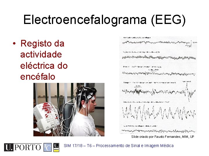 Electroencefalograma (EEG) • Registo da actividade eléctrica do encéfalo Slide criado por Fausto Fernandes,