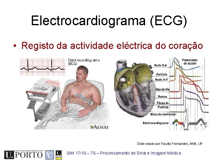 Electrocardiograma (ECG) • Registo da actividade eléctrica do coração Slide criado por Fausto Fernandes,