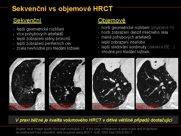 Sekvenční vs objemové HRCT Sekvenční Objemové - - lepší geometrické rozlišení více pohybových artefaktů