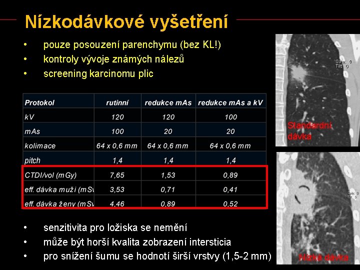 Nízkodávkové vyšetření • • • pouze posouzení parenchymu (bez KL!) kontroly vývoje známých nálezů