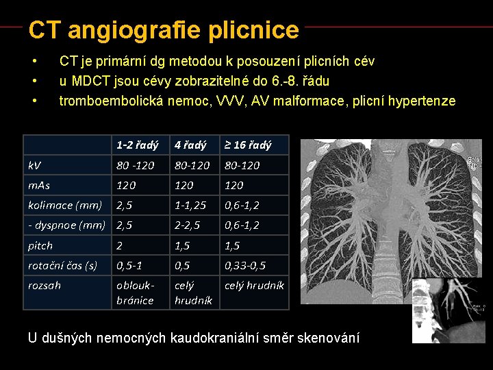 CT angiografie plicnice • • • CT je primární dg metodou k posouzení plicních