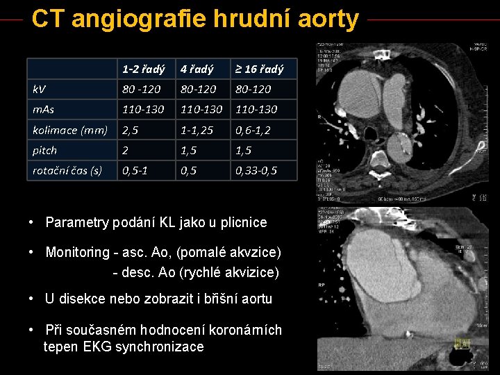 CT angiografie hrudní aorty 1 -2 řadý 4 řadý ≥ 16 řadý k. V