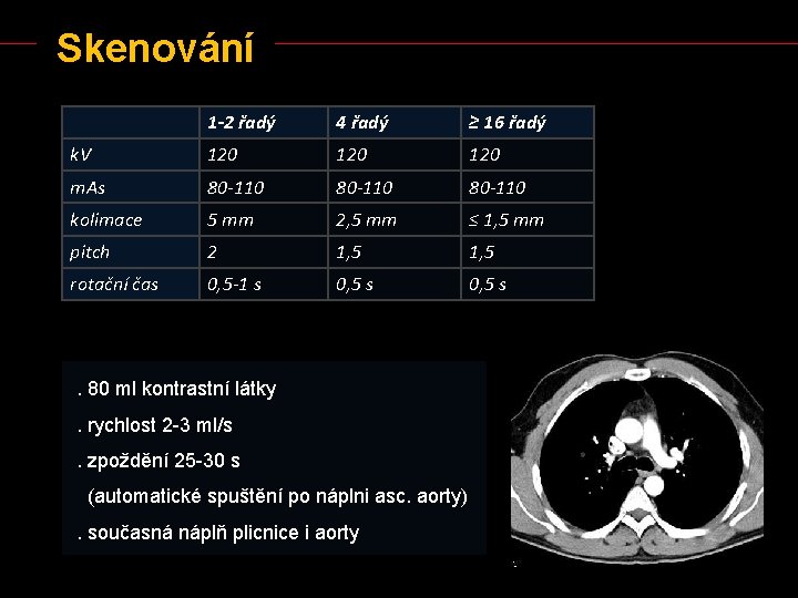 Skenování 1 -2 řadý 4 řadý ≥ 16 řadý k. V 120 120 m.