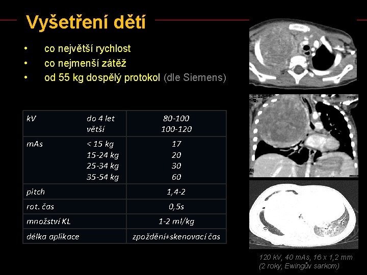 Vyšetření dětí • • • co největší rychlost co nejmenší zátěž od 55 kg