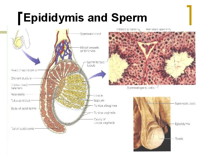 Epididymis and Sperm 