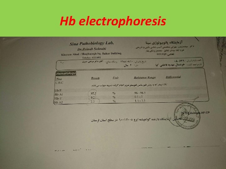 Hb electrophoresis 
