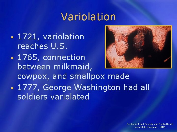 Variolation 1721, variolation reaches U. S. • 1765, connection between milkmaid, cowpox, and smallpox