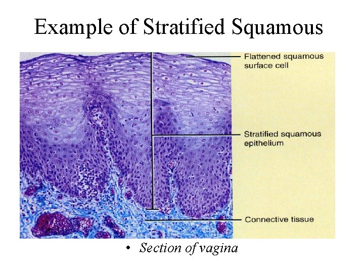 Example of Stratified Squamous • Section of vagina 