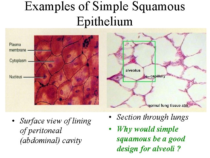 Examples of Simple Squamous Epithelium • Surface view of lining of peritoneal (abdominal) cavity