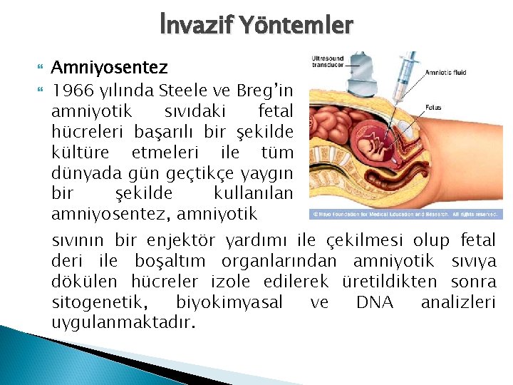 İnvazif Yöntemler Amniyosentez 1966 yılında Steele ve Breg’in amniyotik sıvıdaki fetal hücreleri başarılı bir