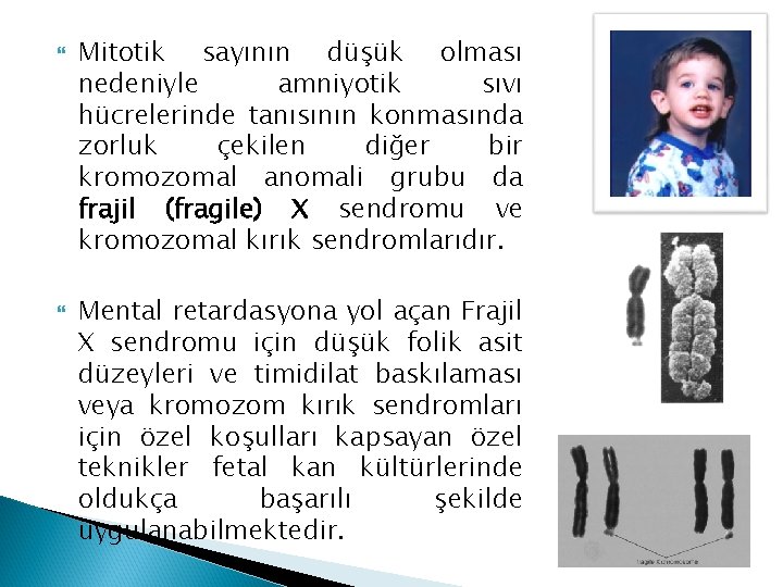 Mitotik sayının düşük olması nedeniyle amniyotik sıvı hücrelerinde tanısının konmasında zorluk çekilen diğer Mitotik sayının düşük olması nedeniyle amniyotik sıvı hücrelerinde tanısının konmasında zorluk çekilen diğer