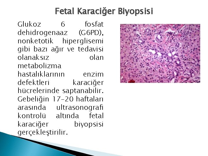 Fetal Karaciğer Biyopsisi Glukoz 6 fosfat dehidrogenaaz (G 6 PD), nonketotik hiperglisemi gibi bazı Fetal Karaciğer Biyopsisi Glukoz 6 fosfat dehidrogenaaz (G 6 PD), nonketotik hiperglisemi gibi bazı