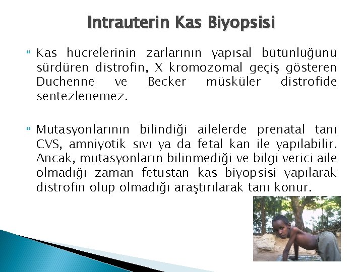 Intrauterin Kas Biyopsisi Kas hücrelerinin zarlarının yapısal bütünlüğünü sürdüren distrofin, X kromozomal geçiş gösteren Intrauterin Kas Biyopsisi Kas hücrelerinin zarlarının yapısal bütünlüğünü sürdüren distrofin, X kromozomal geçiş gösteren