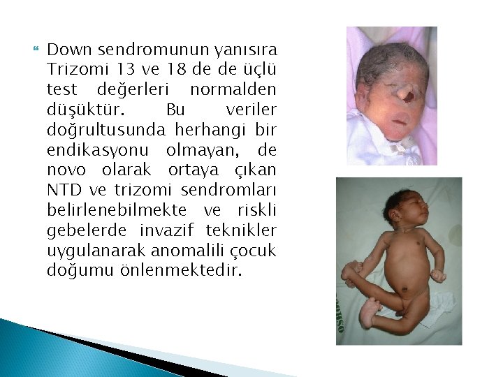 Down sendromunun yanısıra Trizomi 13 ve 18 de de üçlü test değerleri normalden Down sendromunun yanısıra Trizomi 13 ve 18 de de üçlü test değerleri normalden