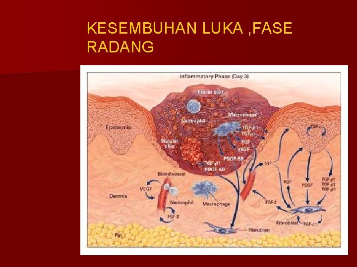 KESEMBUHAN LUKA , FASE RADANG 