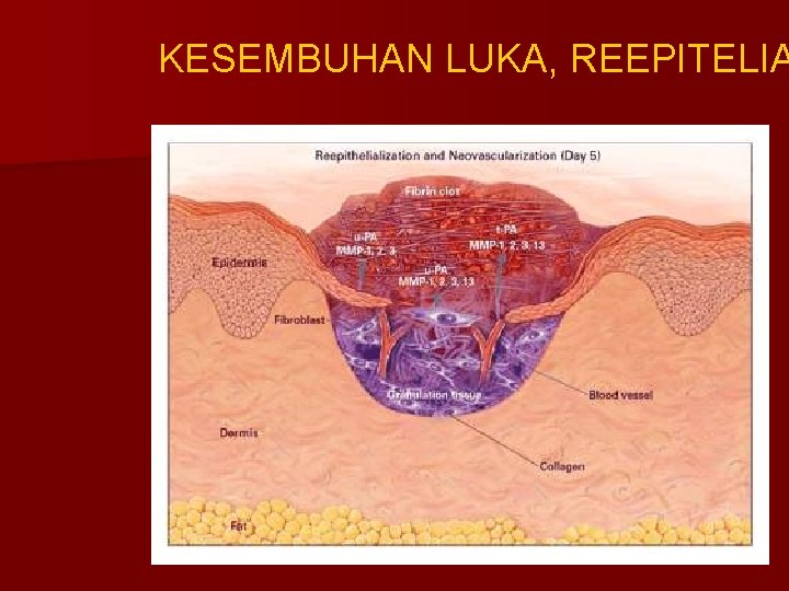 KESEMBUHAN LUKA, REEPITELIA 