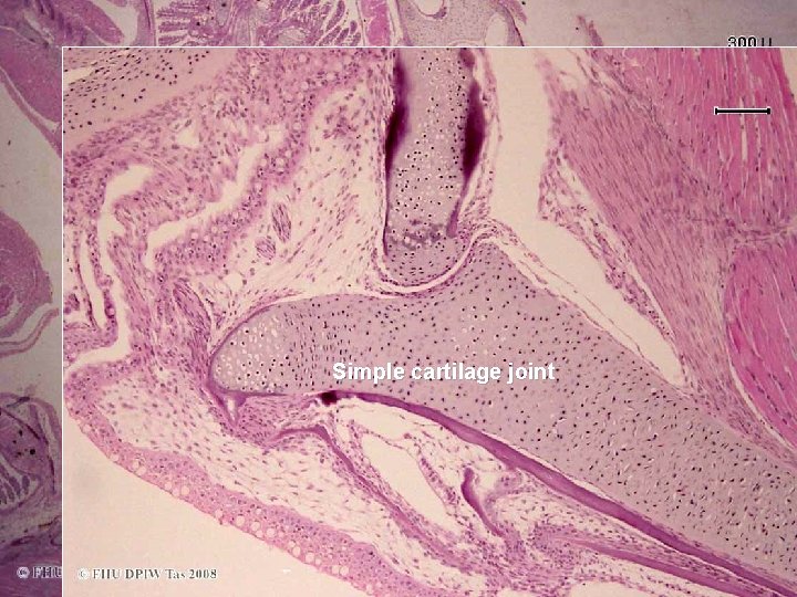 Joint Simple cartilage joint 