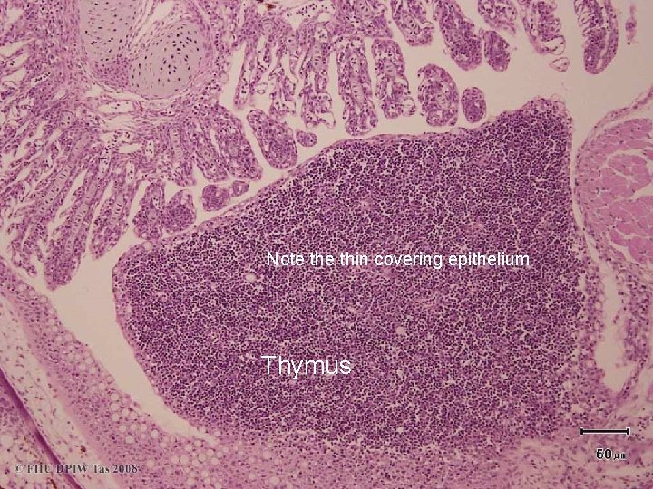 Note thin covering epithelium Thymus 