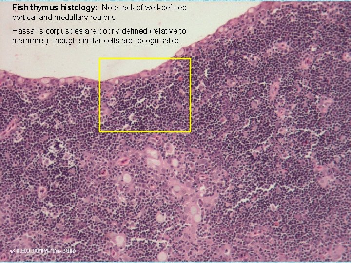 Fish thymus histology: Note lack of well-defined cortical and medullary regions. Hassall’s corpuscles are