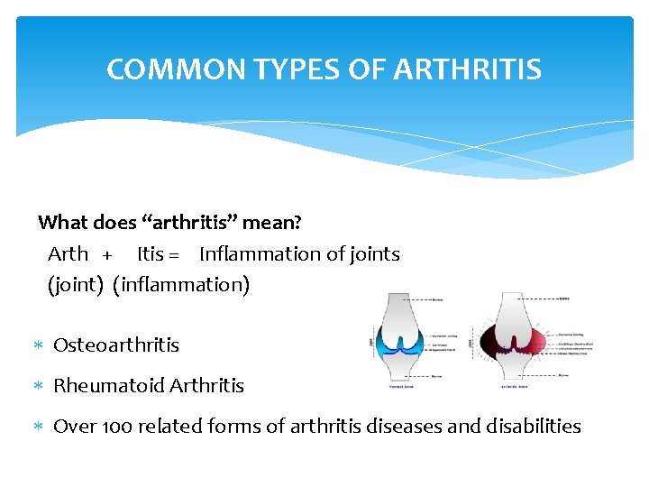 COMMON TYPES OF ARTHRITIS What does “arthritis” mean? Arth + Itis = Inflammation of