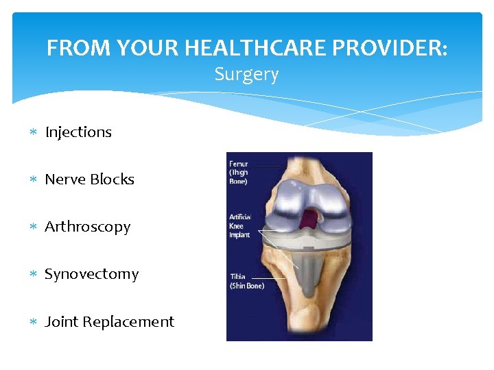FROM YOUR HEALTHCARE PROVIDER: Surgery Injections Nerve Blocks Arthroscopy Synovectomy Joint Replacement 