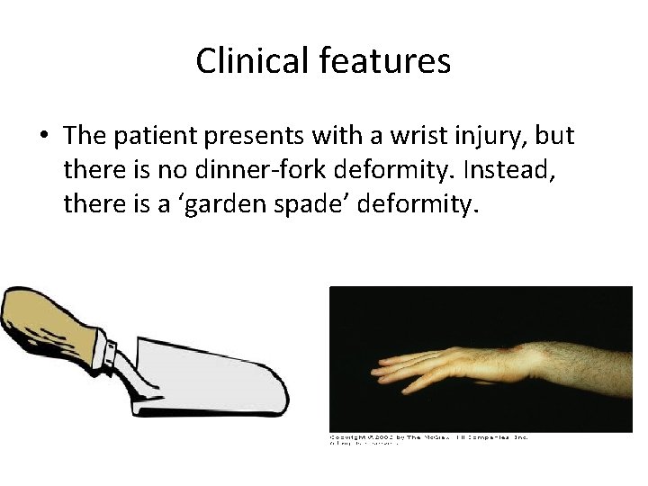 Clinical features • The patient presents with a wrist injury, but there is no