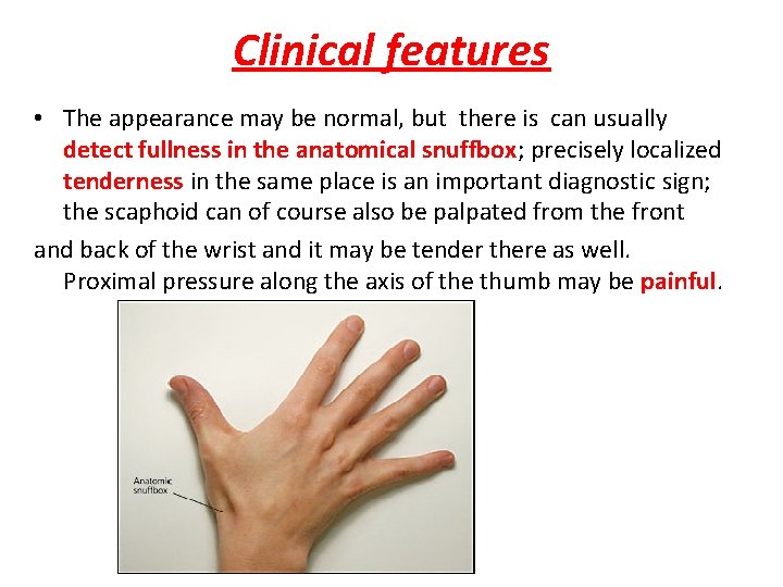 Clinical features • The appearance may be normal, but there is can usually detect