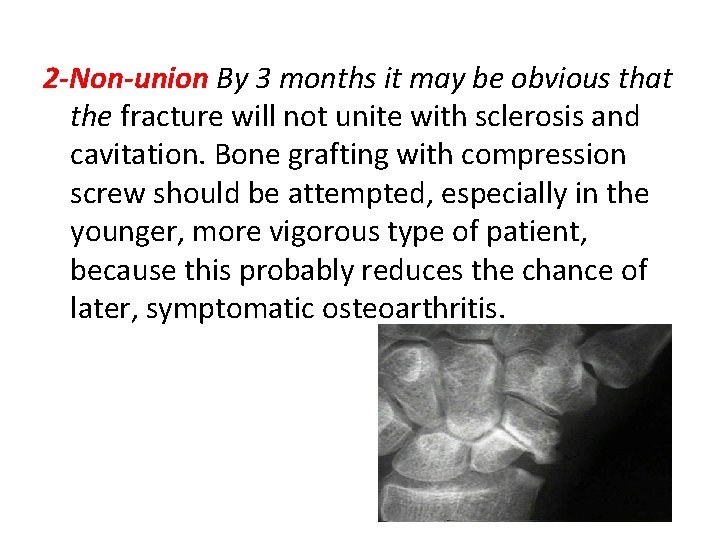 2 -Non-union By 3 months it may be obvious that the fracture will not