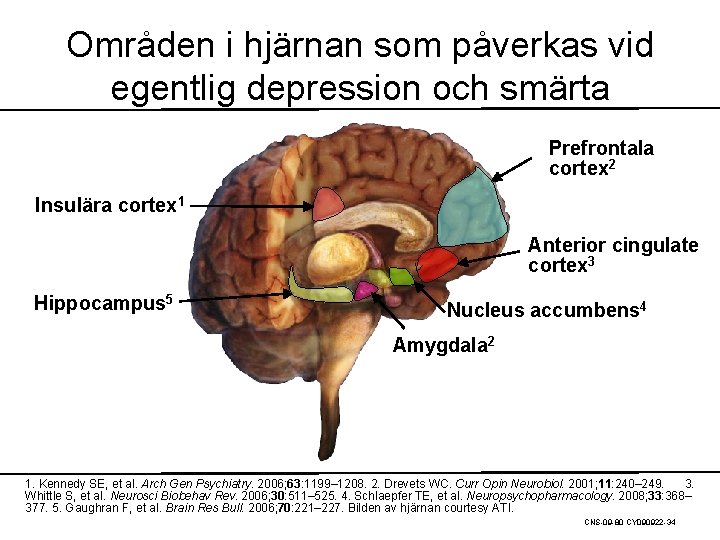 Områden i hjärnan som påverkas vid egentlig depression och smärta Prefrontala cortex 2 Insulära