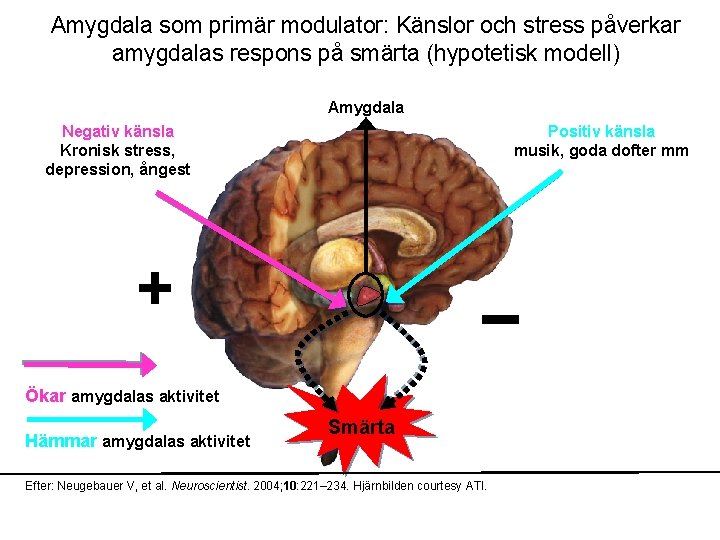 Amygdala som primär modulator: Känslor och stress påverkar amygdalas respons på smärta (hypotetisk modell)