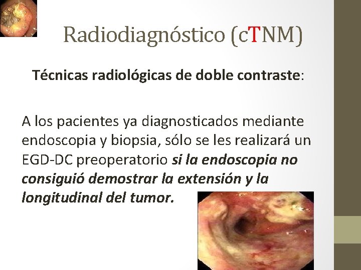 Radiodiagnóstico (c. TNM) Técnicas radiológicas de doble contraste: A los pacientes ya diagnosticados mediante