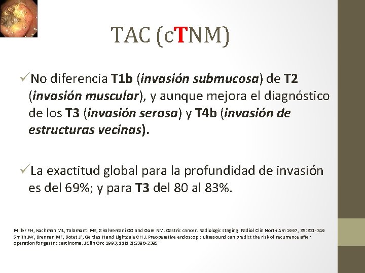 TAC (c. TNM) üNo diferencia T 1 b (invasión submucosa) de T 2 (invasión