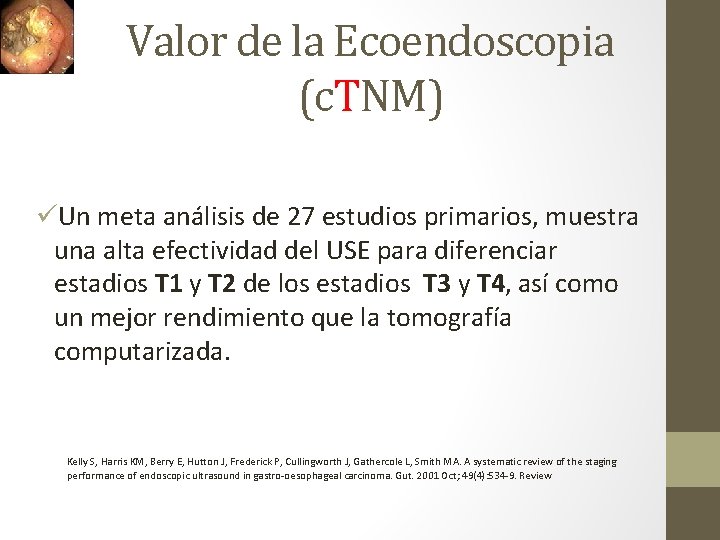 Valor de la Ecoendoscopia (c. TNM) üUn meta análisis de 27 estudios primarios, muestra