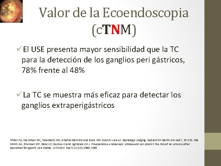 Valor de la Ecoendoscopia (c. TNM) üEl USE presenta mayor sensibilidad que la TC