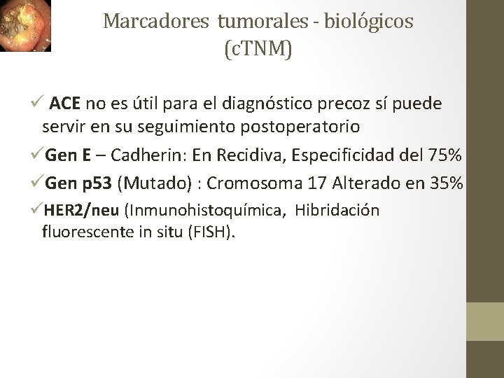 Marcadores tumorales - biológicos (c. TNM) ü ACE no es útil para el diagnóstico