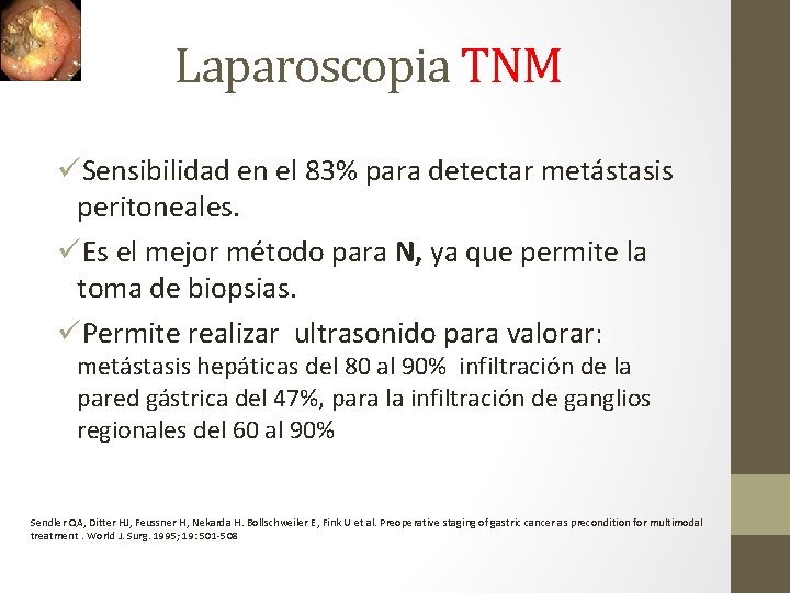 Laparoscopia TNM üSensibilidad en el 83% para detectar metástasis peritoneales. üEs el mejor método