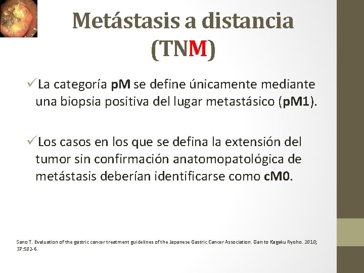Metástasis a distancia (TNM) üLa categoría p. M se define únicamente mediante una biopsia