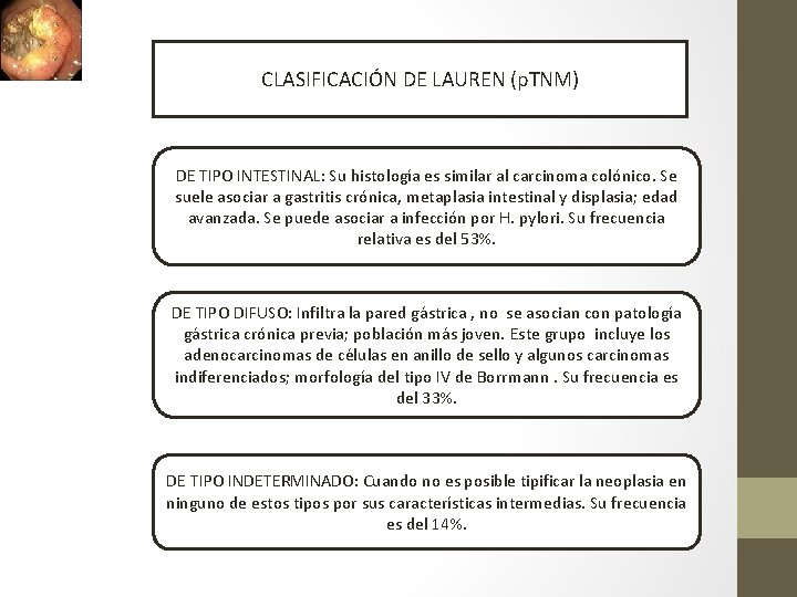 CLASIFICACIÓN DE LAUREN (p. TNM) DE TIPO INTESTINAL: Su histología es similar al carcinoma