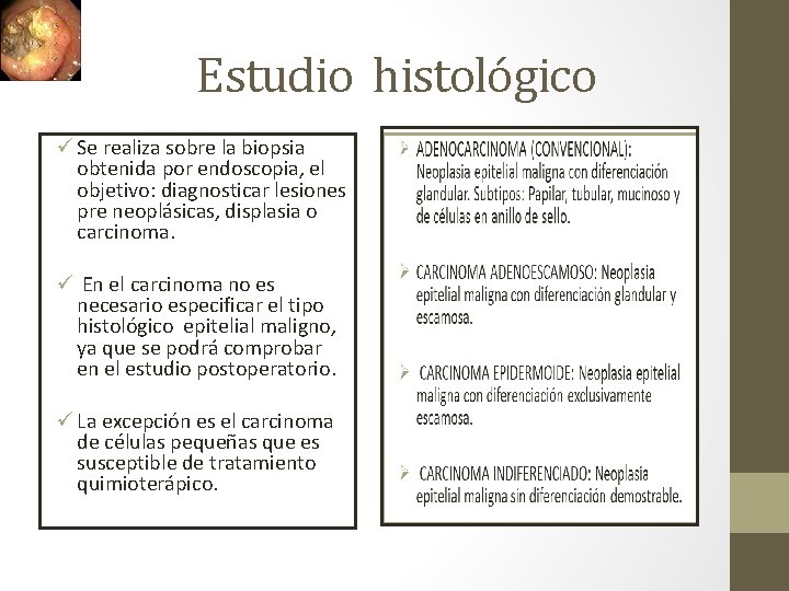 Estudio histológico ü Se realiza sobre la biopsia obtenida por endoscopia, el objetivo: diagnosticar