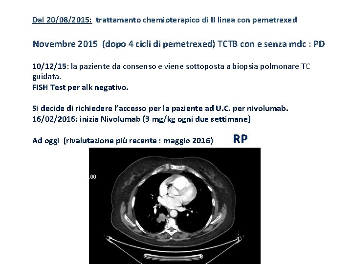 Dal 20/08/2015: trattamento chemioterapico di II linea con pemetrexed Novembre 2015 (dopo 4 cicli