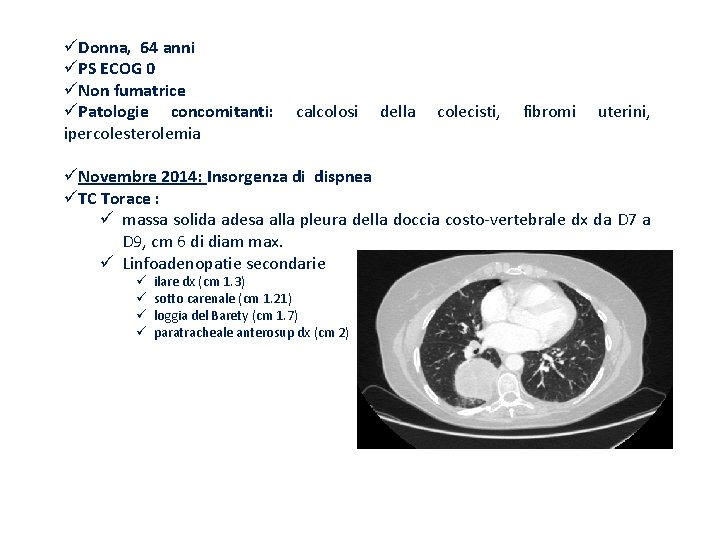 üDonna, 64 anni üPS ECOG 0 üNon fumatrice üPatologie concomitanti: ipercolesterolemia calcolosi della colecisti,