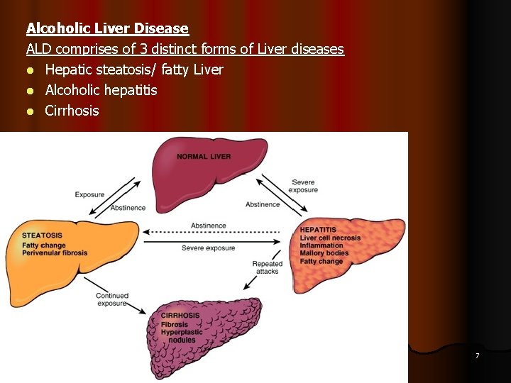 Alcoholic Liver Disease ALD comprises of 3 distinct forms of Liver diseases l Hepatic