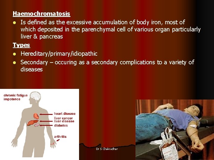 Haemochromatosis l Is defined as the excessive accumulation of body iron, most of which