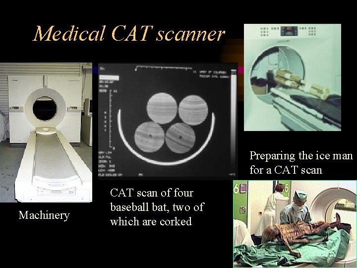 Medical CAT scanner Preparing the ice man for a CAT scan Machinery CAT scan