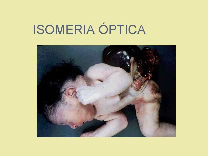 ISOMERIA ÓPTICA 