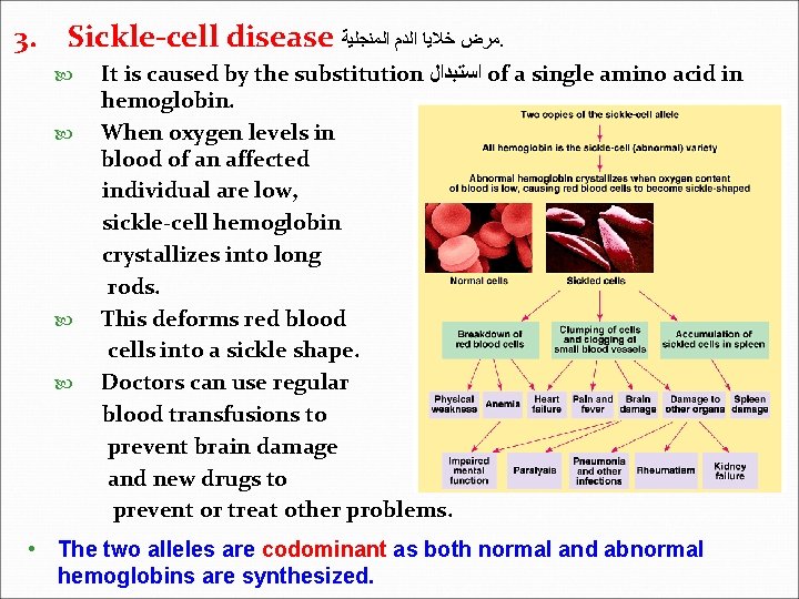 3. Sickle-cell disease ﻣﺮﺽ ﺧﻼﻳﺎ ﺍﻟﺪﻡ ﺍﻟﻤﻨﺠﻠﻴﺔ. It is caused by the substitution ﺍﺳﺘﺒﺪﺍﻝ