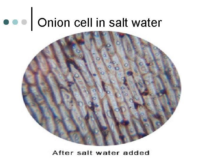Onion cell in salt water 