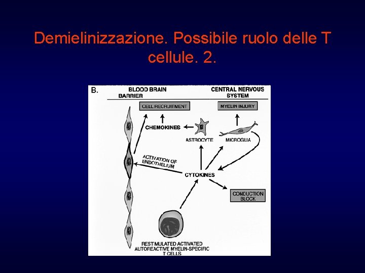 Demielinizzazione. Possibile ruolo delle T cellule. 2. 