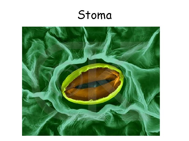 Stoma 